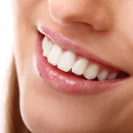 Teeths Whitening